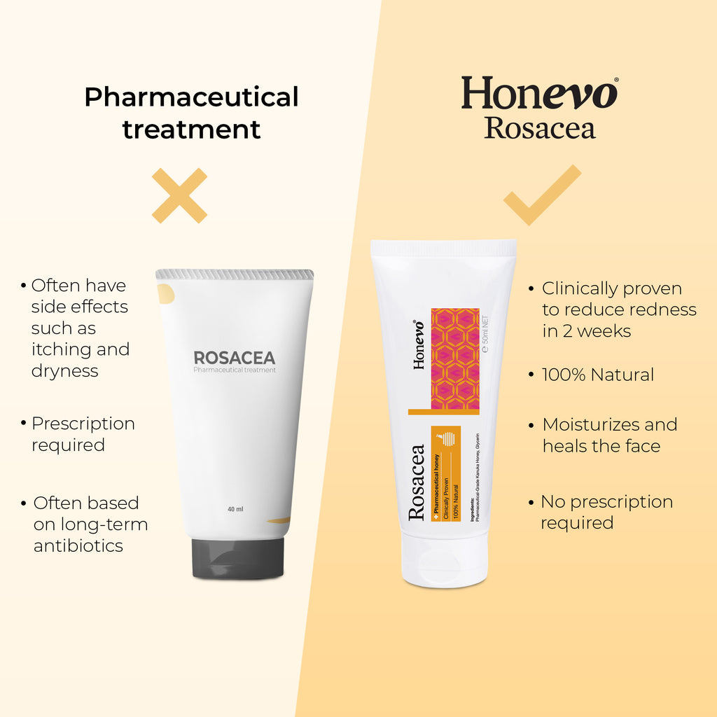 Honevo for Rosacea